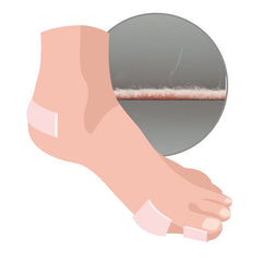 Mollskinn plåster 4 pack